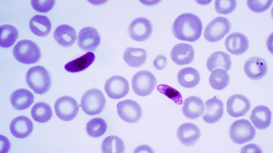 Nejnebezpečnějším původcem malárie je prvok zimnička tropická (Plasmodium falciparum), který se vyskytuje v tropech Afriky, Asie i Ameriky