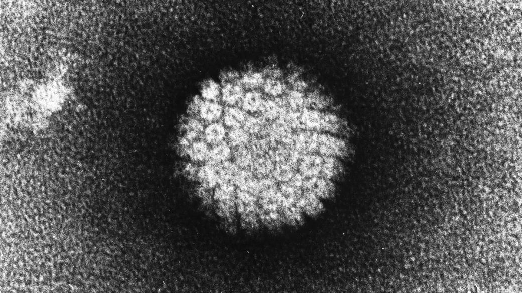 Lidský papilomavirus (HPV) na snímku z elektronového mikroskopu