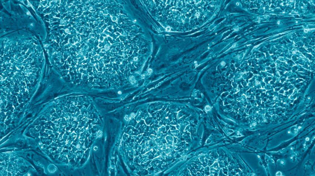 Lidské embryonální kmenové buňky