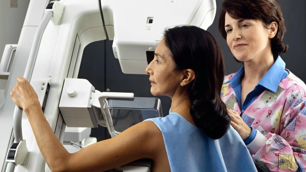 Preventivní screeningová mamografie 