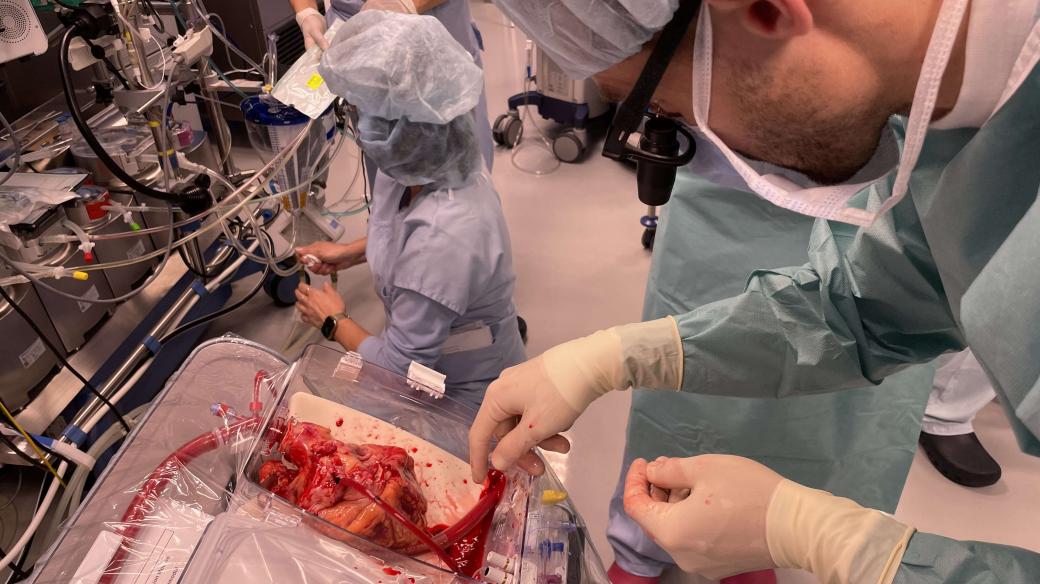 Lékaři dávají  srdce do průhledné krabičky a napojují ho na přístroj