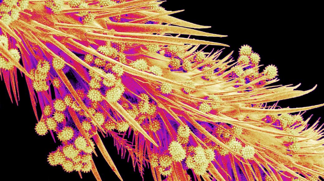 Pylová zrna zachycená elektronovým mikroskopem na noze včely medonosné