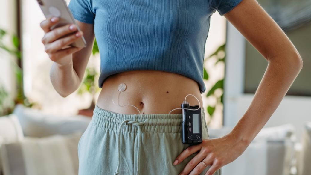 Chytrá inzulinová pumpa ulehčuje život diabetikům i práci lékařům