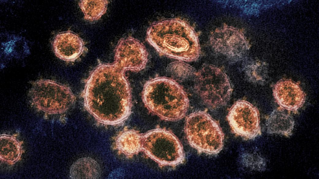 Nový koronavirus: snímek viru SARS-CoV-2, který způsobuje nemoc COVID-19, pod elektronovým mikroskopem. Výběžky na vnějším okraji vytvářejí podobu koróny či koruny, dle čehož se koronaviry označují. Fotografie od amerického úřadu National Institute of Hea
