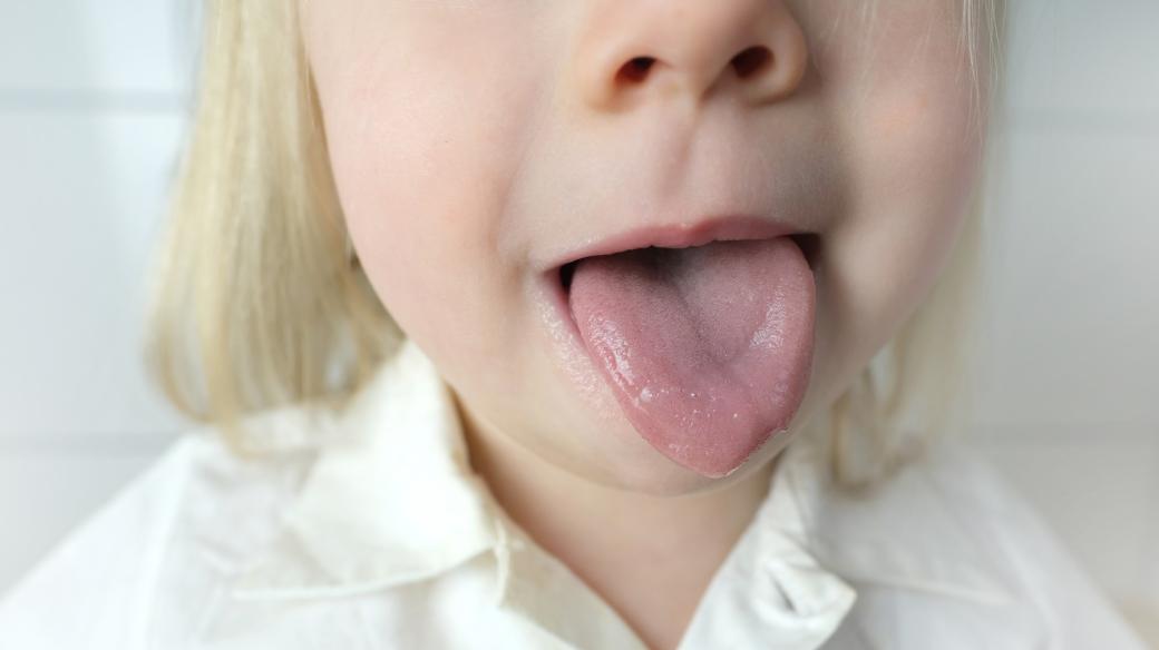 Malé dítě vyplazuje jazyk (ilustrační foto)