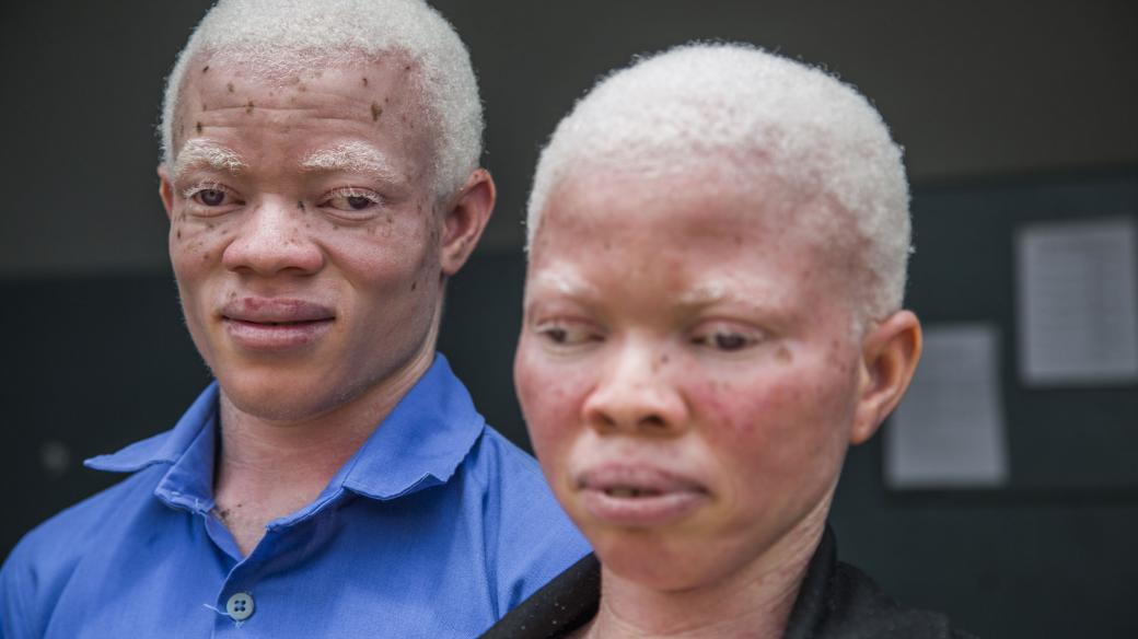 Bílá nosí smrt. Dokument o osudu albínů v africké Ghaně