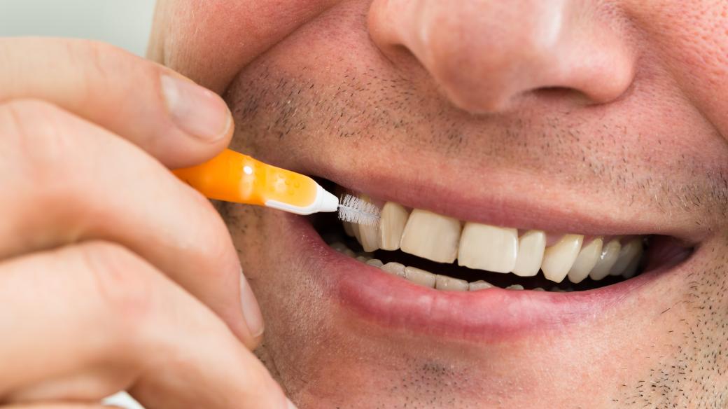Čištění zubů mezizubním kartáčkem