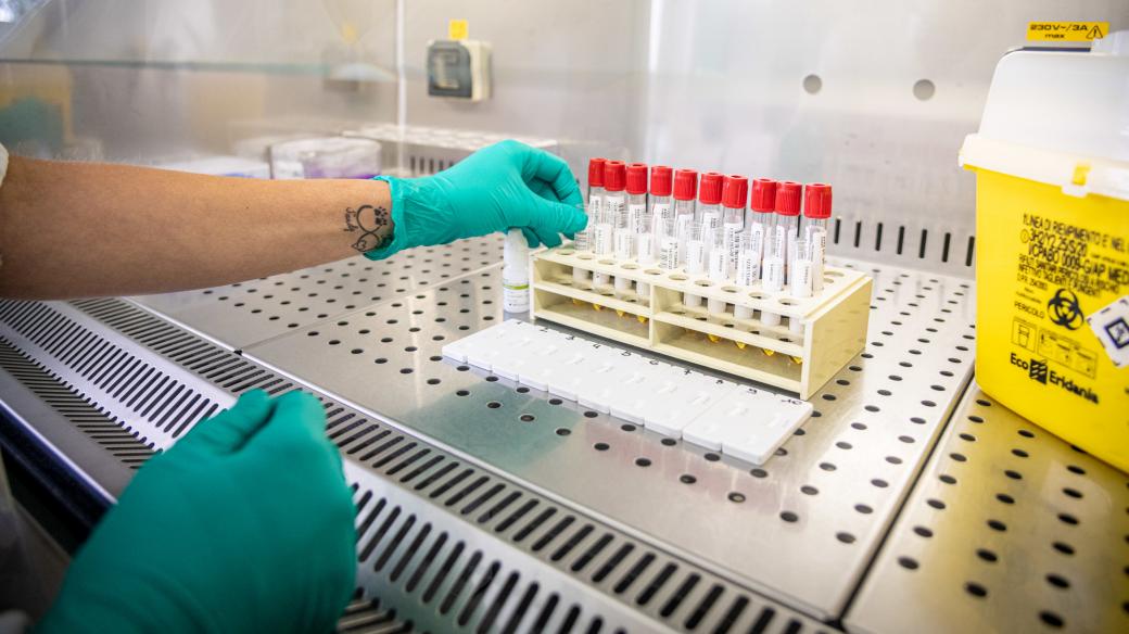 Laboratoř zpracovává testy na koronavirus