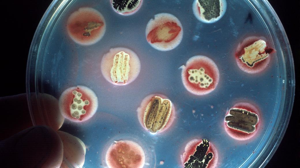 Výzkum antibiotik - testování jejich účinnosti proti různým patogenům (ilustrační foto)