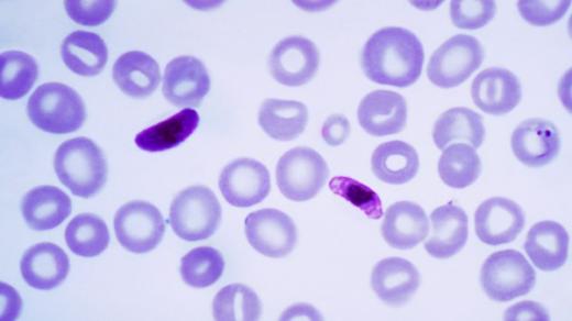 Nejnebezpečnějším původcem malárie je prvok zimnička tropická (Plasmodium falciparum), který se vyskytuje v tropech Afriky, Asie i Ameriky