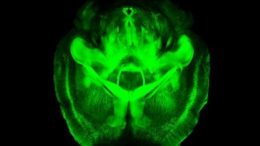 Mozek myši zobrazený metodou Clarity