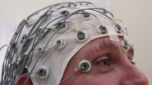 epilepsie - EEG