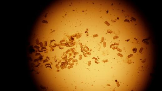 Glochidia perlorodky říční pod mikroskopem