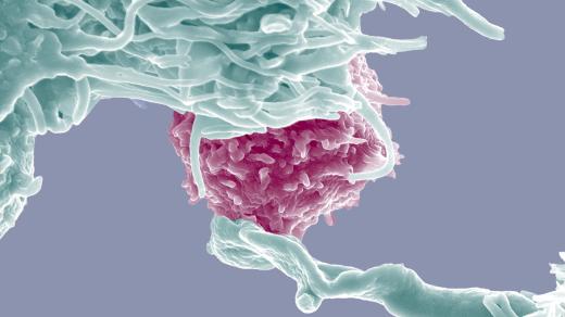  Dendritické buňky a T lymfocyty, dvě složky imunitního systému těla (SEM)