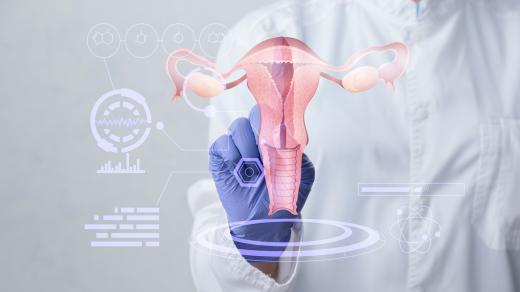 Moci bez nemoci: Sestup dělohy a defekt pánevního dna