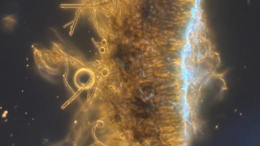 Řez stěnou hálky. Nalevo volné mycelium, uprostřed jeho pevné vrstvy a vpravo rostlinné pletivo (svítící)