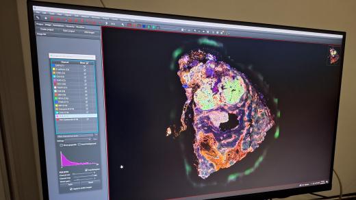 Fenocyklér umožňuje identifikovat až 100 klíčových markerů na vzorcích jaterní tkáně