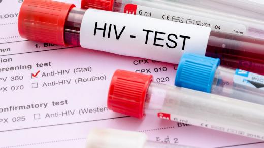 Vyšetření na virus HIV