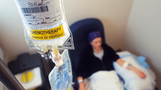 Chemoterapie je stále jednou ze čtyř základních metod léčby rakoviny