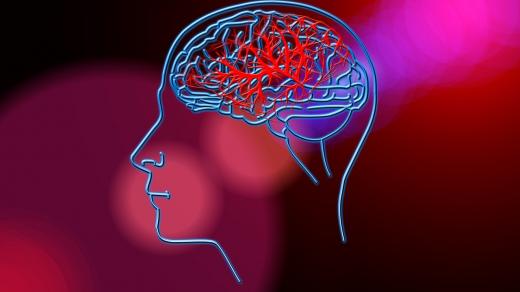 Před hrozící cévní mozkovou příhodou někdy organismus člověka varuje prostřednictvím krátkodobých příznaků. Nevyplatí se je podceňovat