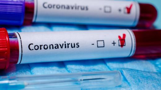 Koronavirus, vzorek, test, laboratoř, odběr krve, Covid-19, nákaza, ilustrační