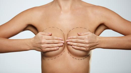Poprsí před plastickou operací