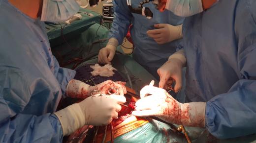 „ V hrudní chirurgii musíme mít světla na hlavě, protože se často musíme podívat někam za roh, do hloubky, a to s operační lampou nejde,“ komentuje operatér