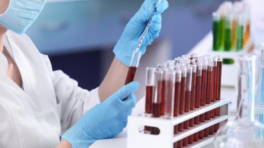 Laboratorní testy už dlouho pomáhají lékařům vyznat se v původcích nakažlivých onemocnění.
