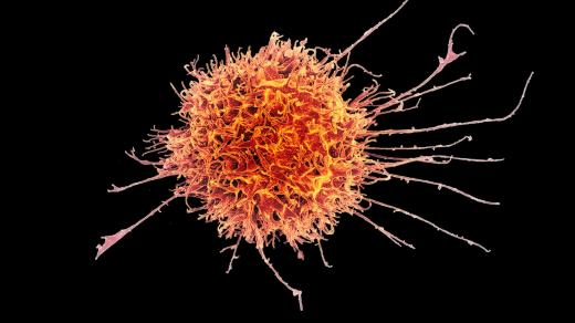 NK buňka lidského imunitního systému je schopná rozeznat virem napadenou nebo nádorovou buňku a zlikvidovat ji