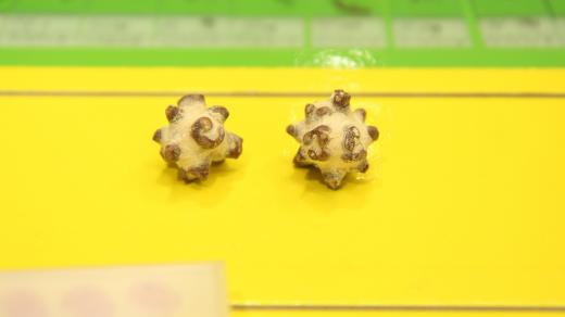 Kameny z močového měchýře, které mají netypický tvar ježka v kleci