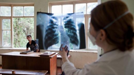Tuberkulóza: lékařka v centru pro infekční choroby, AIDS a tuberkulózu v gruzínském Batumi prohlíží rentgenový snímek. 