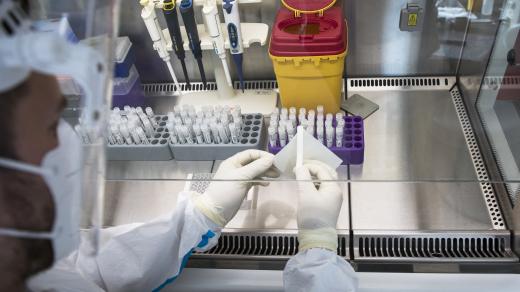 Například laboratoř GHC Genetics spotřebuje na jeden test až dvacet pipetovacích špiček