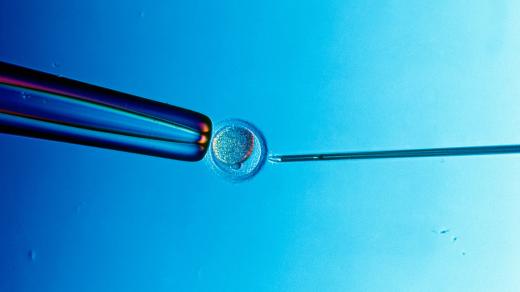 Umělé oplodnění IVF (ilustrační foto)